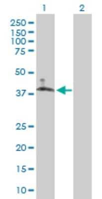 Western Blot: SLC10A6 Antibody [H00345274-B01P]