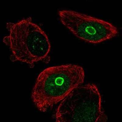 Immunocytochemistry/ Immunofluorescence: SLC10A7 Antibody [NBP2-58231]