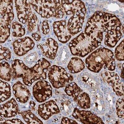 Immunohistochemistry: SLC10A7 Antibody [NBP1-86784]