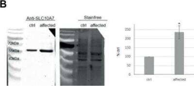 Western Blot: SLC10A7 Antibody [NBP1-59875]