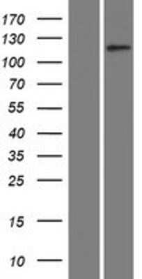 Western Blot: NKCC2/SLC12A1 Overexpression Lysate [NBP2-09034]