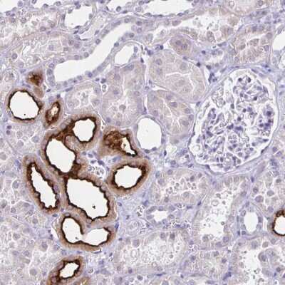 Immunohistochemistry-Paraffin: SLC12A3 Antibody [NBP1-86376]