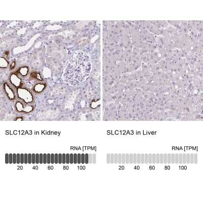 Immunohistochemistry-Paraffin: SLC12A3 Antibody [NBP1-86376]