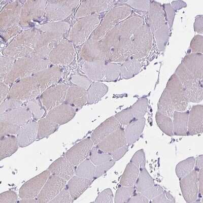Immunohistochemistry-Paraffin: SLC12A3 Antibody [NBP1-86376]