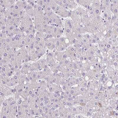 Immunohistochemistry-Paraffin: SLC12A3 Antibody [NBP1-86376]