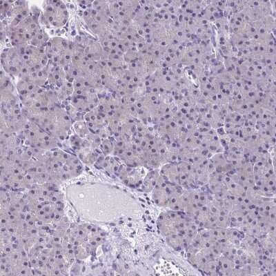 Immunohistochemistry-Paraffin: SLC12A3 Antibody [NBP1-86376]