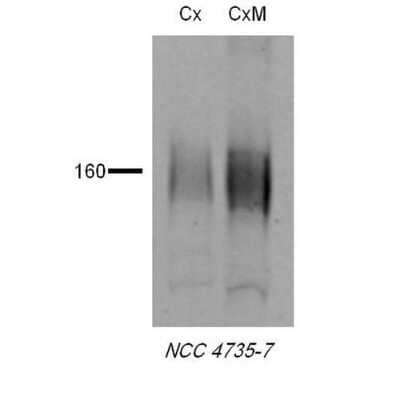 Western Blot: SLC12A3 Antibody [NBP1-44270]