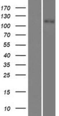 Western Blot: SLC12A3 Overexpression Lysate [NBP2-09035]