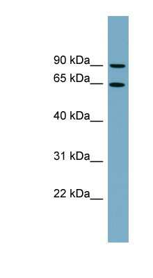 Western Blot: SLC12A8 Antibody [NBP1-59893]