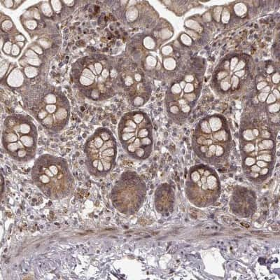 Immunohistochemistry-Paraffin: SLC12A9 Antibody [NBP2-68858]