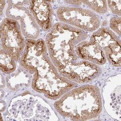 Immunohistochemistry: SLC13A1 Antibody [NBP2-38970]