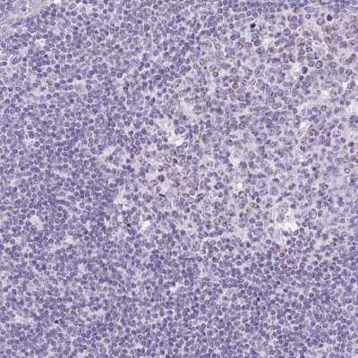 Immunohistochemistry-Paraffin: SLC13A1 Antibody [NBP2-30984]