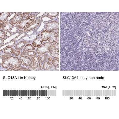 Immunohistochemistry-Paraffin: SLC13A1 Antibody [NBP2-30984]