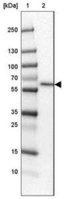 Western Blot: SLC13A1 Antibody [NBP2-30984]