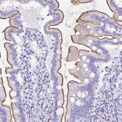 Immunohistochemistry-Paraffin: SLC13A2 Antibody [NBP1-82604]