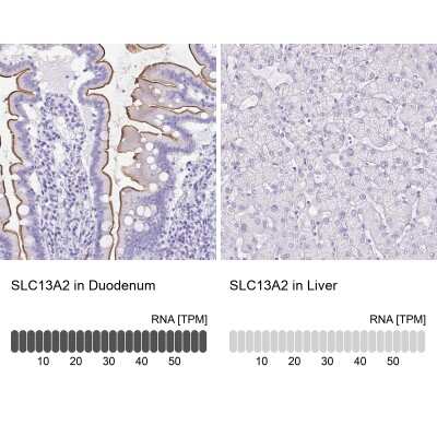 Immunohistochemistry-Paraffin: SLC13A2 Antibody [NBP1-82604]