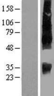 Western Blot: SLC13A2 Overexpression Lysate [NBP2-07930]