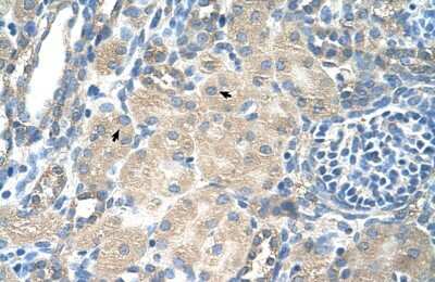 Immunohistochemistry-Paraffin: SLC13A3/NaDC3 Antibody [NBP1-60011]