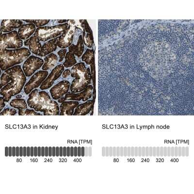Immunohistochemistry-Paraffin: SLC13A3/NaDC3 Antibody [NBP1-82603]