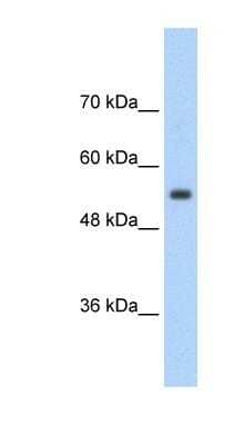 Western Blot: SLC13A3/NaDC3 Antibody [NBP1-60011]