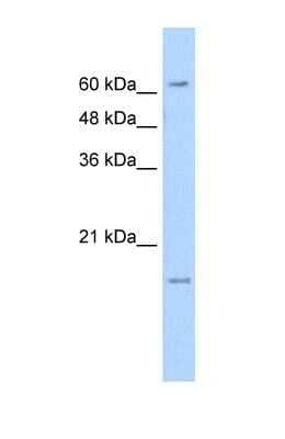 Western Blot: SLC13A3/NaDC3 Antibody [NBP1-69630]