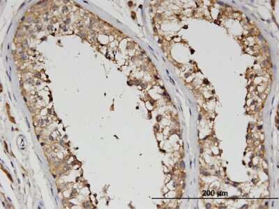 Immunohistochemistry-Paraffin: SLC13A5 Antibody (2G4) [H00284111-M06]