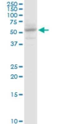 Western Blot: SLC13A5 Antibody (2G4) [H00284111-M06]