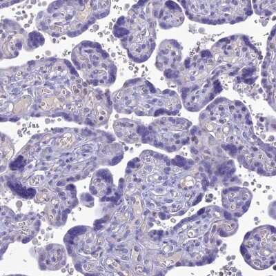 Immunohistochemistry-Paraffin: SLC13A5 Antibody [NBP1-92394]