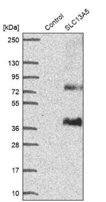 Western Blot: SLC13A5 Antibody [NBP1-92394]