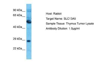 Western Blot: SLC13A5 Antibody [NBP2-85736]