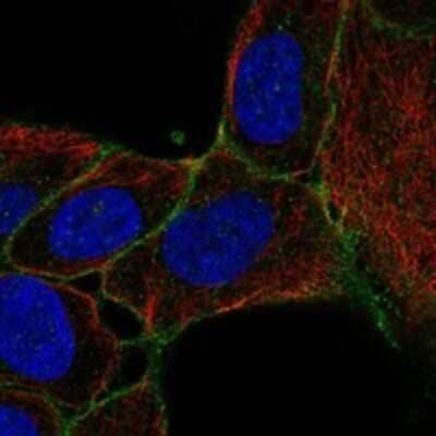 Immunocytochemistry/ Immunofluorescence: SLC14A1 Antibody [NBP3-17770]