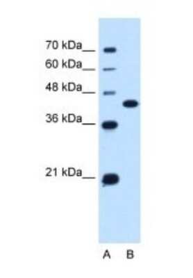 Western Blot: SLC14A1 Antibody [NBP1-60115]