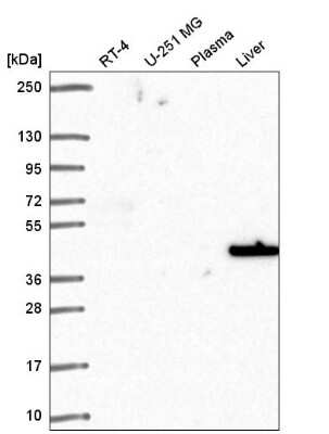 Western Blot: SLC14A1 Antibody [NBP2-58203]