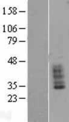 Western Blot: SLC14A1 Overexpression Lysate [NBL1-16011]