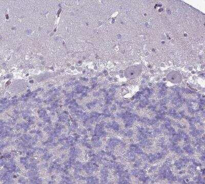 Immunohistochemistry-Paraffin: SLC15A3 Antibody [NBP1-92422]