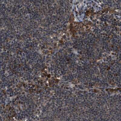 Immunohistochemistry-Paraffin: SLC15A4 Antibody [NBP1-87279]