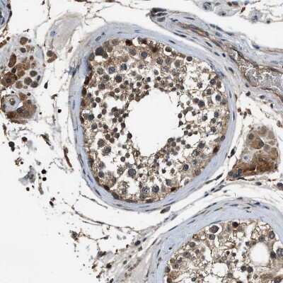 Immunohistochemistry-Paraffin: SLC15A4 Antibody [NBP1-87279]