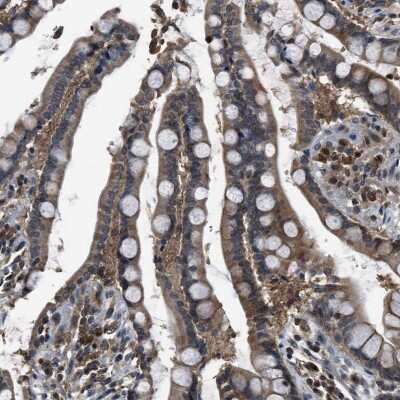 Immunohistochemistry-Paraffin: SLC15A4 Antibody [NBP1-87279]