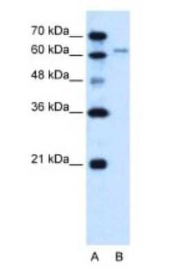 Western Blot: SLC15A4 Antibody [NBP1-59636]