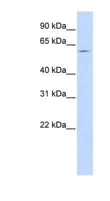 Western Blot: SLC15A4 Antibody [NBP1-59637]