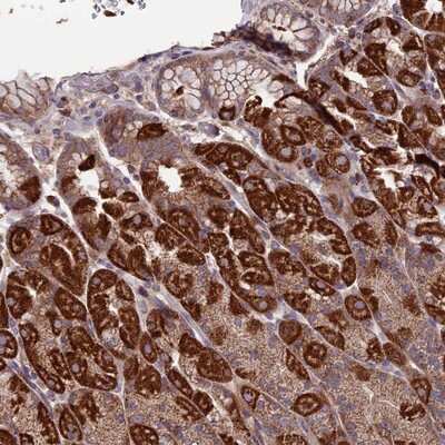 Immunohistochemistry-Paraffin: SLC15A5 Antibody [NBP2-14511]