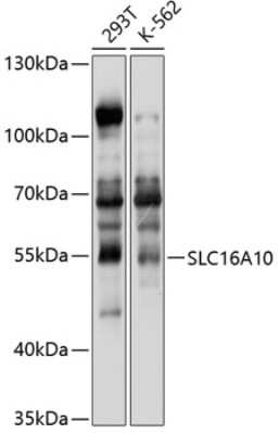 Western Blot: SLC16A10 AntibodyBSA Free [NBP3-05049]