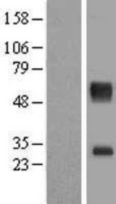 Western Blot: SLC16A11 Overexpression Lysate [NBL1-16014]