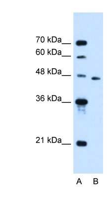 Western Blot: SLC16A12 Antibody [NBP1-59530]