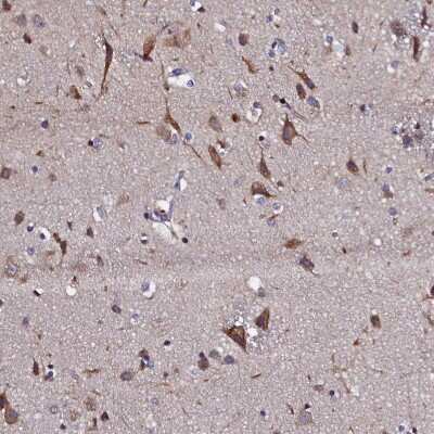 Immunohistochemistry-Paraffin: SLC16A14 Antibody [NBP1-83542]