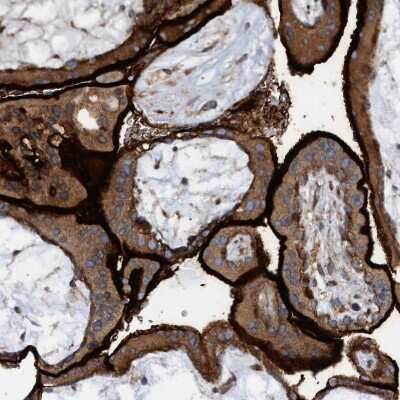 Immunohistochemistry-Paraffin: SLC16A3 Antibody [NBP1-81251]