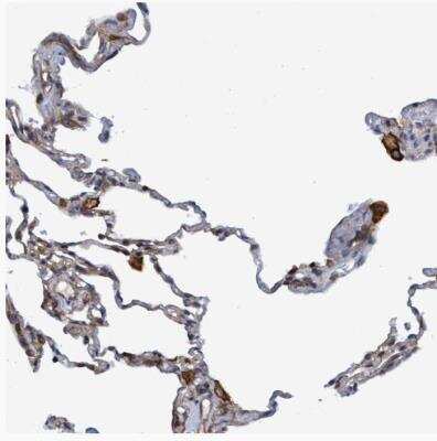 Immunohistochemistry-Paraffin: SLC16A3 Antibody [NBP1-81251]