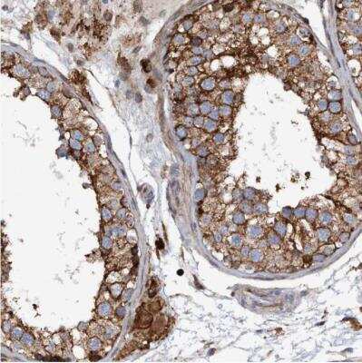 Immunohistochemistry-Paraffin: SLC16A3 Antibody [NBP1-81251]