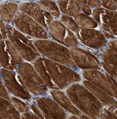 Immunohistochemistry-Paraffin: SLC16A3 Antibody [NBP1-81251]