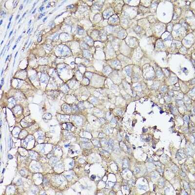 Immunohistochemistry-Paraffin: SLC16A3 Antibody - Azide and BSA Free [NBP2-94186]